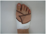 Bandage and 3-toe Socks in Combination