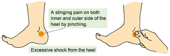 pain in inside of foot near heel