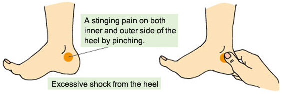 Stinging Pain Inside And Outside Of Heel KASAHARA FOOT CARE