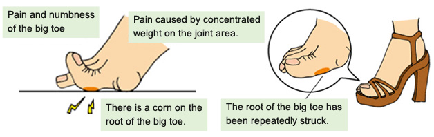 Pain And Numbness Of The Big Toe KASAHARA FOOT CARE