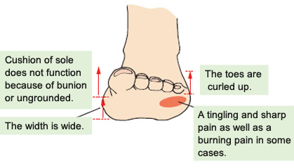 shooting pain in sole of foot